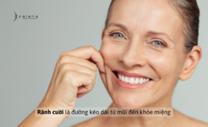 Hiệu quả và độ bền của filler nếp gấp