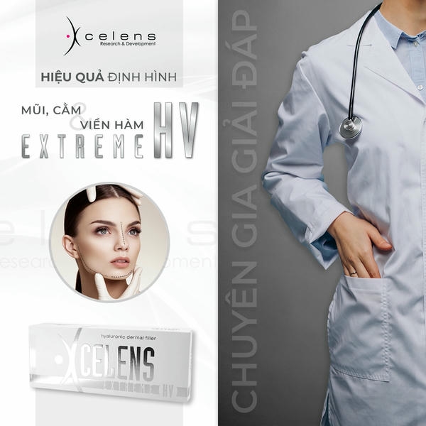 So sánh ngắn: filler HA so với các giải pháp khác