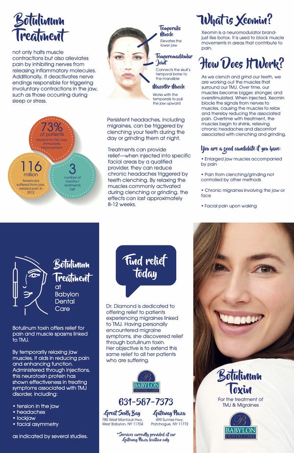 Xeomin có phải là lựa chọn đầu tay cho migraine treatment