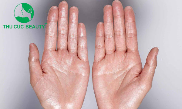 So sánh với các lựa chọn điều trị tăng tiết khác