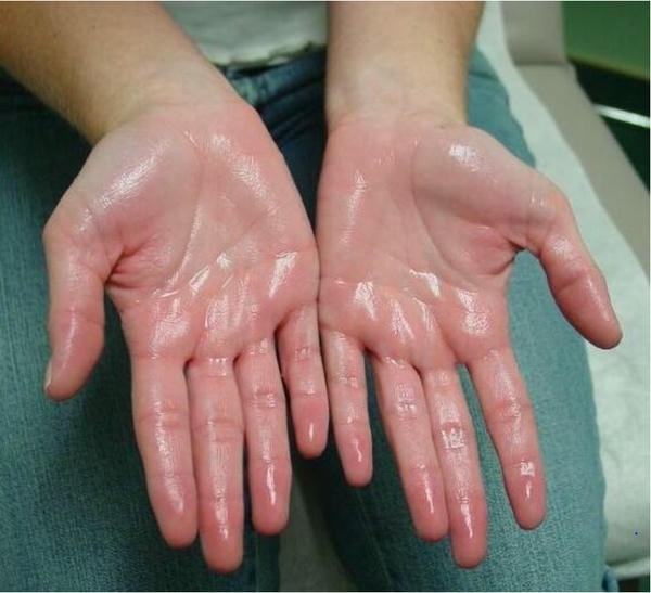 Xeomin hôi nách: quy trình khám và điều trị