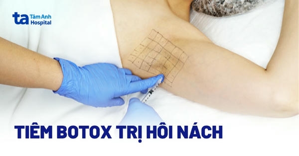 Lưu ý pháp lý và chứng nhận