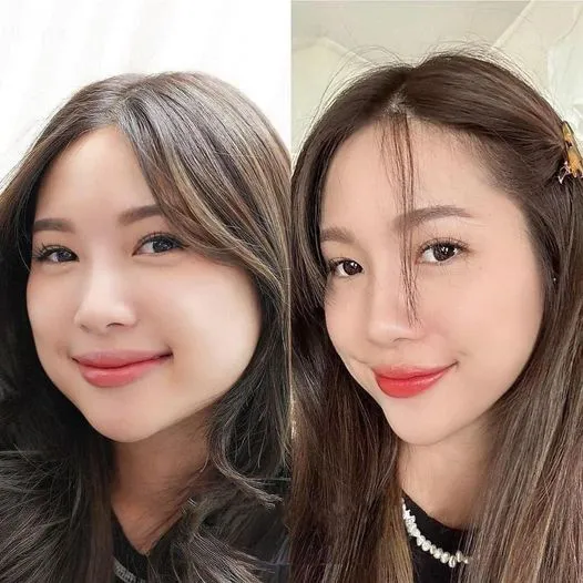 Trường hợp nên cân nhắc thêm