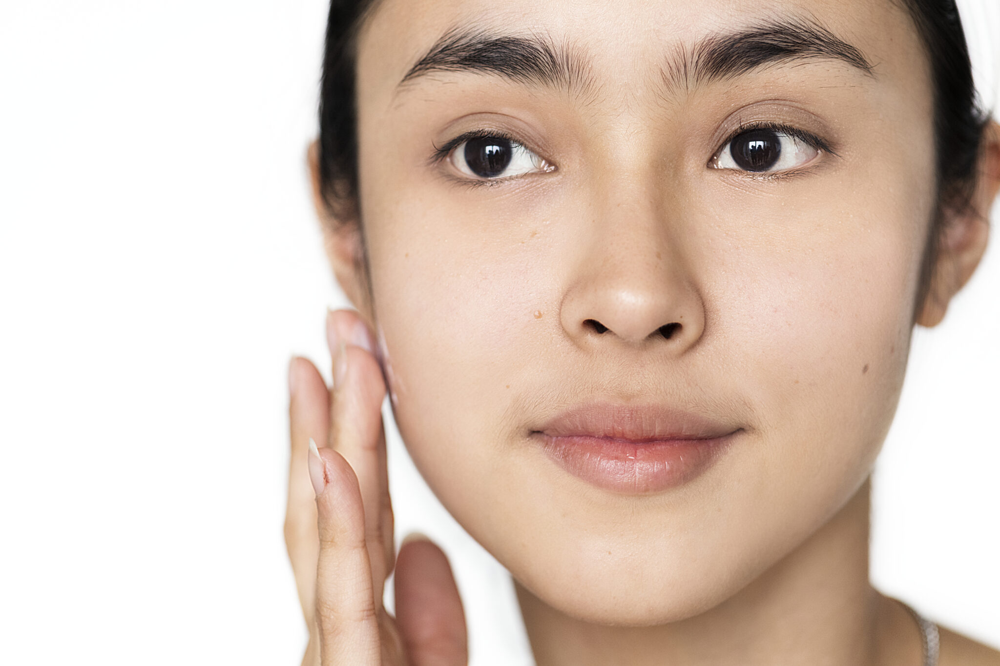 sẹo hỗn hợp, sẹo hỗn hợp, điều trị sẹo hỗn hợp, sẹo rỗ, tái tạo da, Lona Skin Lab