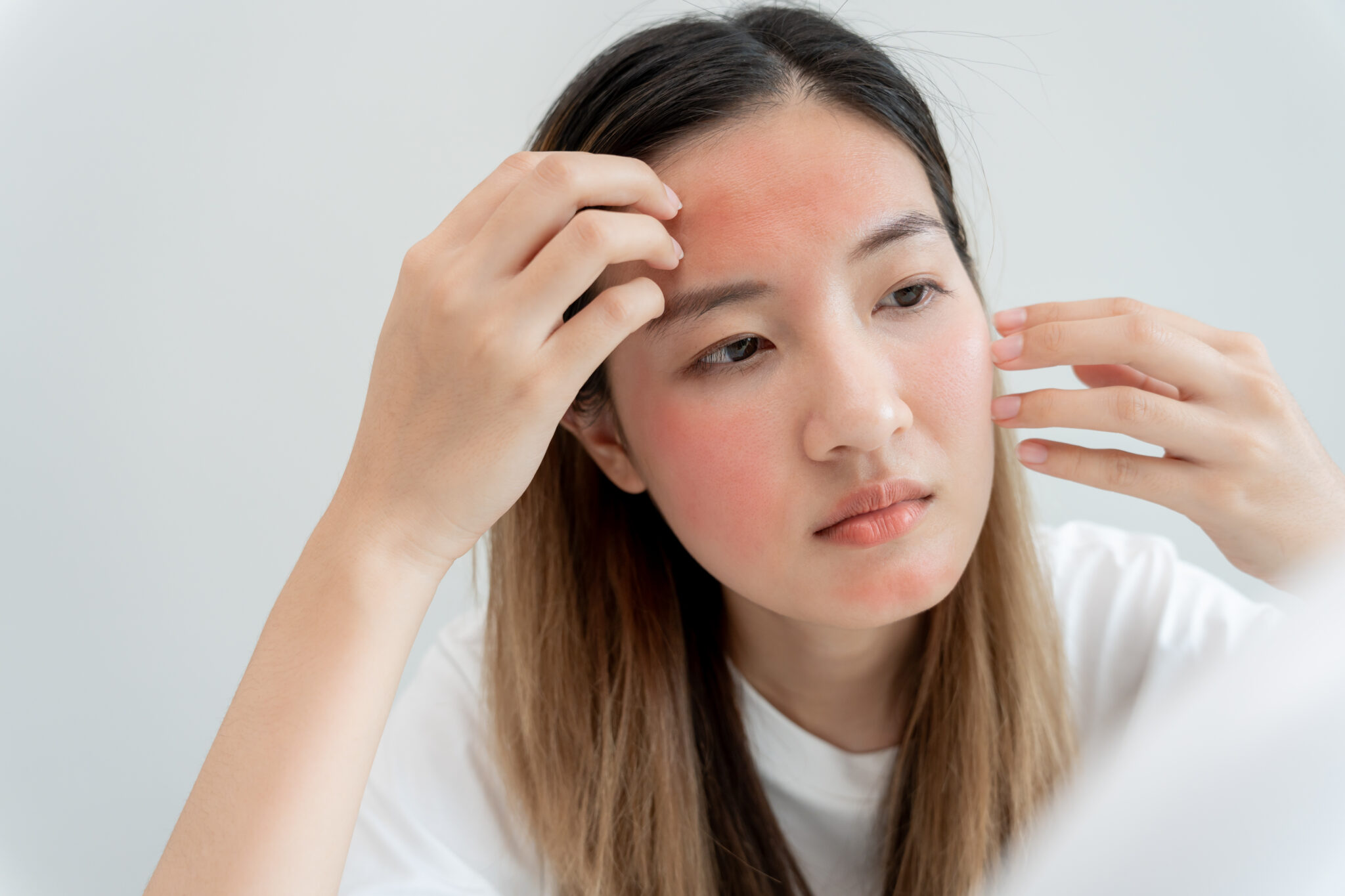 ISOV da nhạy cảm, ISOV da nhạy cảm, mỹ phẩm ISOV Hàn Quốc, sản phẩm chăm sóc da nhạy cảm, ISOV cho da nhạy cảm, mỹ phẩm Hàn Quốc cho da nhạy cảm