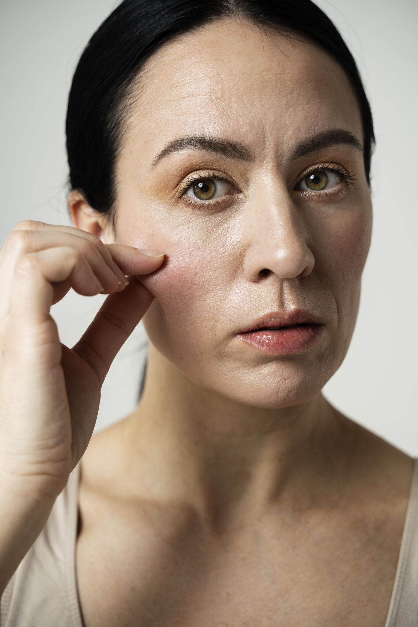 ISOV Peptide, ISOV Peptide, chống lão hóa, tái tạo collagen, trẻ hóa da, Serum Meso Fills Isov