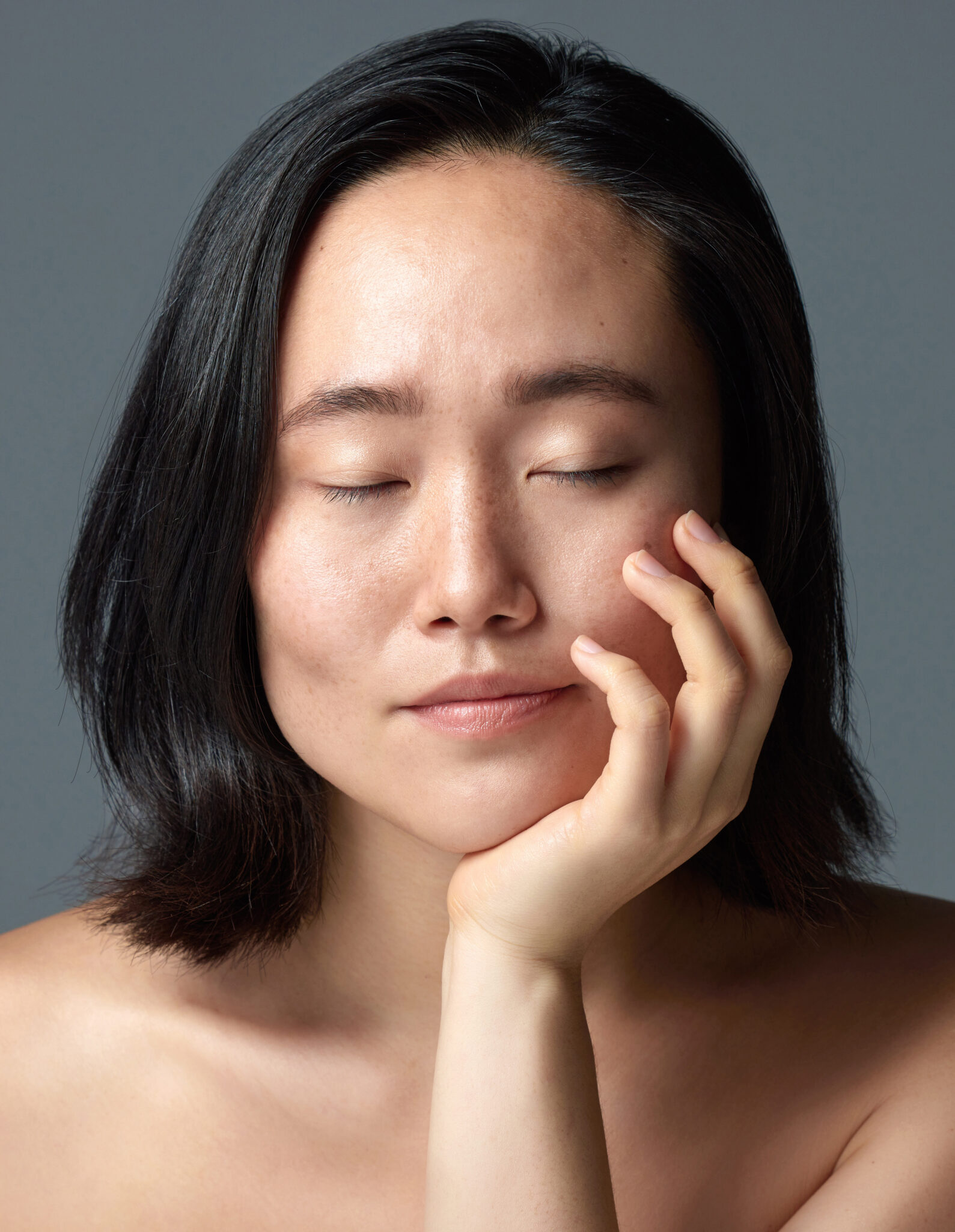 tăng sắc tố, tăng sắc tố, điều trị tăng sắc tố, nám da, thâm mụn, Lona Skin Lab