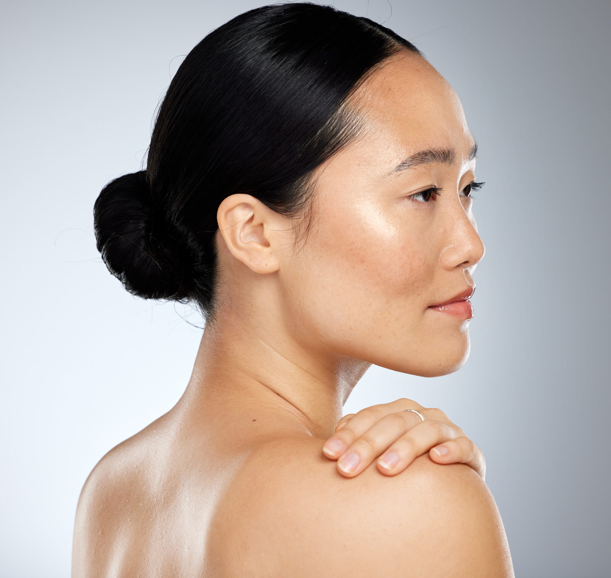 tăng sắc tố, tăng sắc tố, điều trị tăng sắc tố, nám da, thâm mụn, Lona Skin Lab