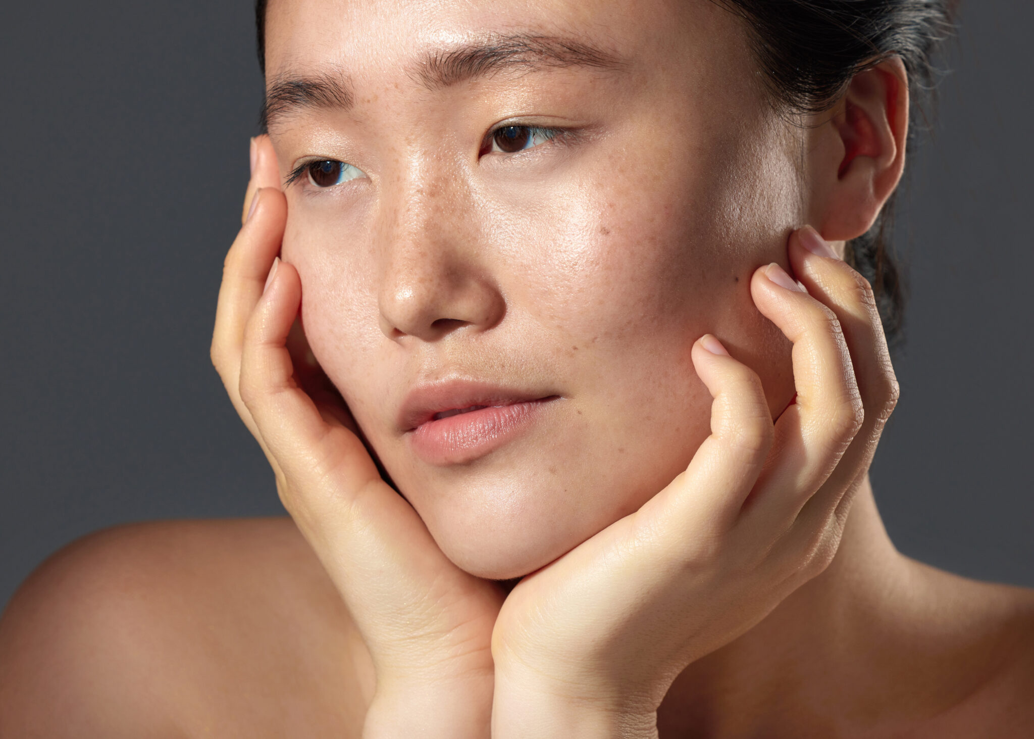 tăng sắc tố, tăng sắc tố, điều trị tăng sắc tố, nám da, thâm mụn, Lona Skin Lab