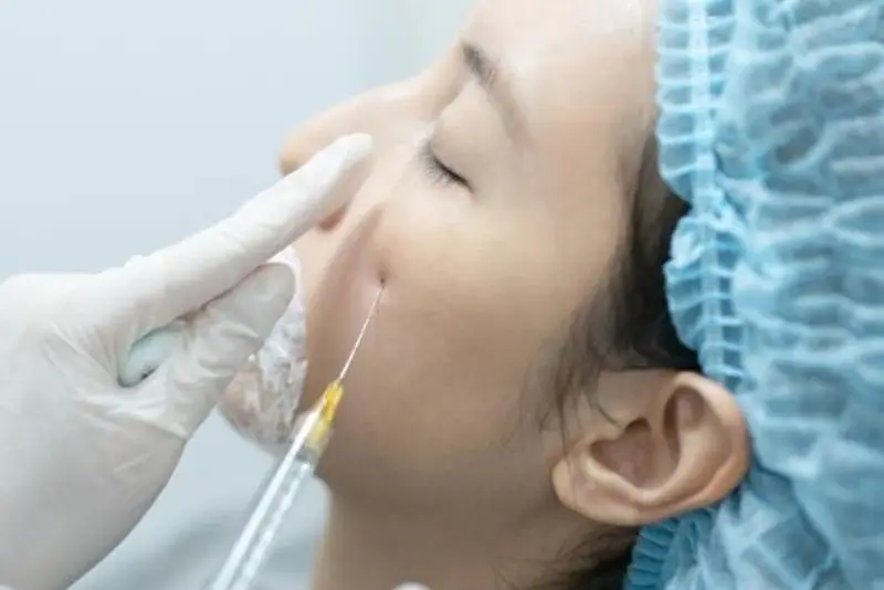 Lời khuyên khi cân nhắc tiêm filler ở tuổi trẻ