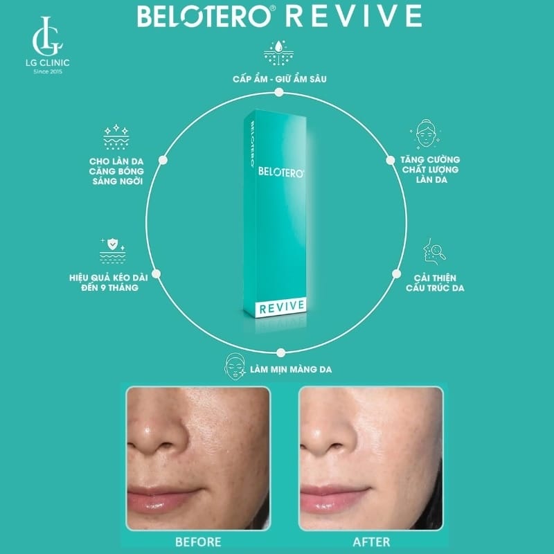 Belotero Meso hoạt động ra sao theo cơ chế hyaluronic acid?