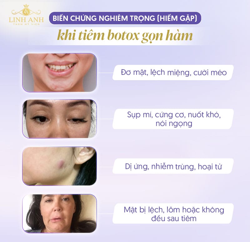 Bầm tím, sưng và đau tại chỗ