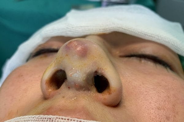 Chăm sóc sau tiêm — những lưu ý đơn giản nhưng quan trọng