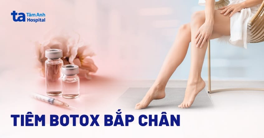 Tiêm botox bắp chân có thực sự làm thon và giảm chu vi bắp chân không?