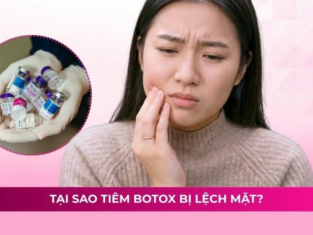 Lợi ích — rủi ro — ai phù hợp và ai nên tránh can thiệp chỉnh lệch bằng Botox?