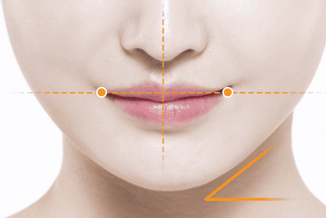 Làm sao để chọn nơi an toàn để sửa lỗi Botox mặt lệch — tiêu chí cần kiểm tra?