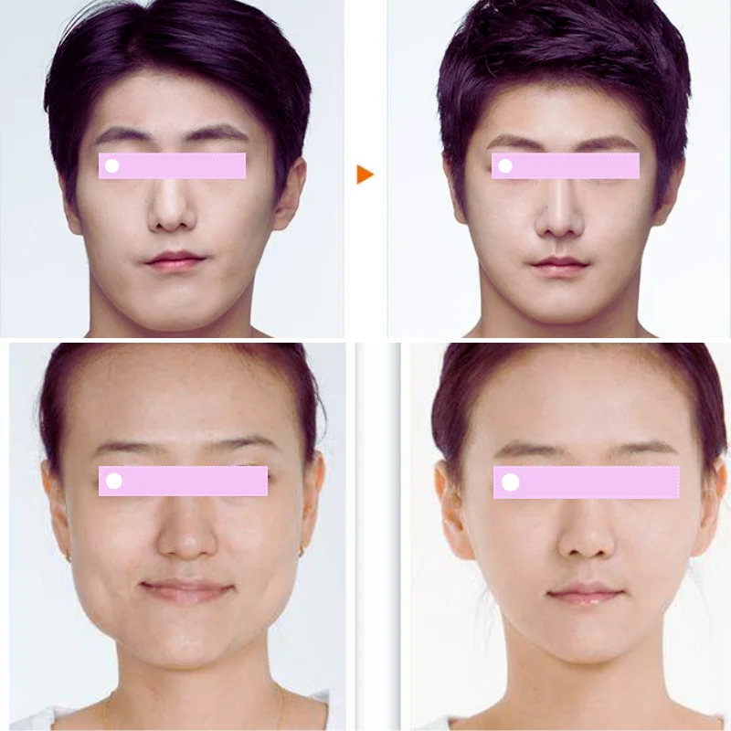 Những câu hỏi nên hỏi bác sĩ trong buổi tư vấn để giảm rủi ro mặt lệch