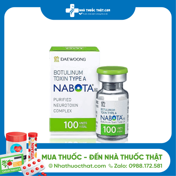 Ai nên chọn Nabota, ai nên chọn sản phẩm khác?