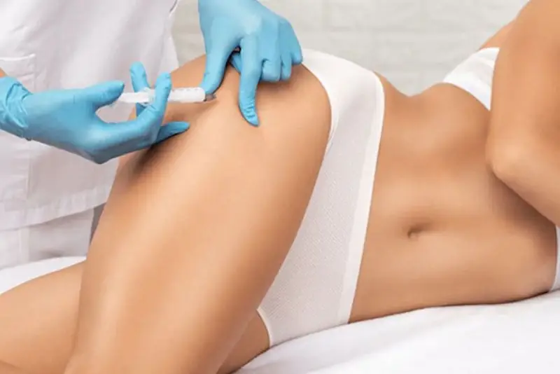Bao lâu thấy kết quả và duy trì khi nâng mông không phẫu thuật?
