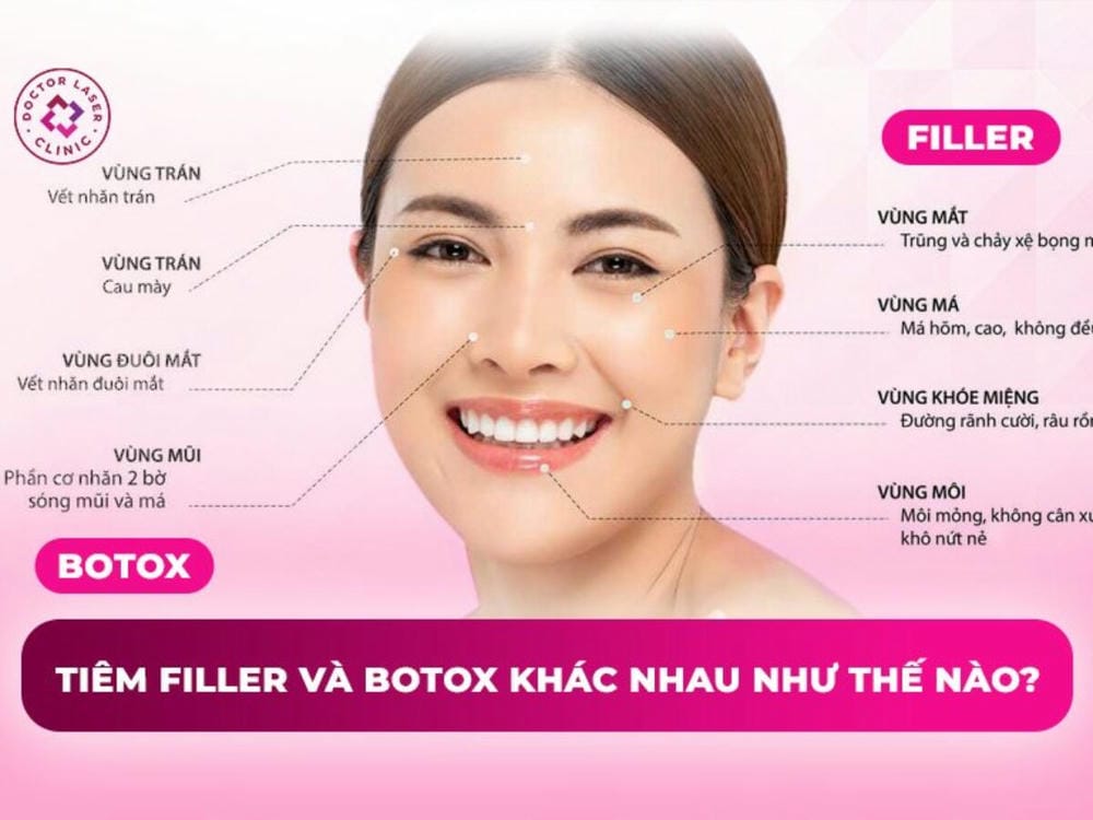 Filler chất làm đầy là gì — có bao nhiêu loại và chọn loại nào an toàn?
