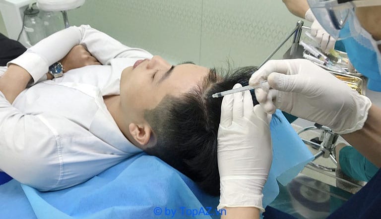 Thủ thuật và liệu pháp bổ trợ: PRP tóc, LLLT, microneedling