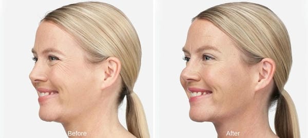 Quy trình tiêm và chăm sóc — những bước cần nắm