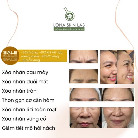 Botulax khác gì so với Botox hay các thương hiệu khác — chọn loại nào an toàn và hiệu quả?