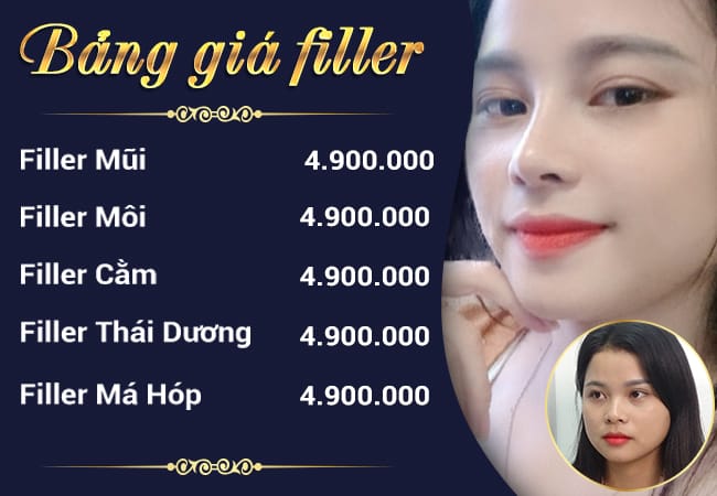 Loại filler nào thường dùng cho cằm — chọn loại nào cho an toàn và tự nhiên?