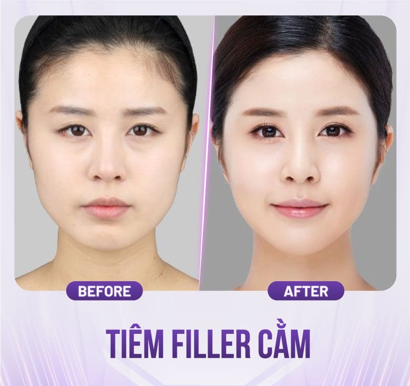 Muốn bắt đầu: những bước tiếp theo hợp lý để có kết quả tự nhiên và an toàn