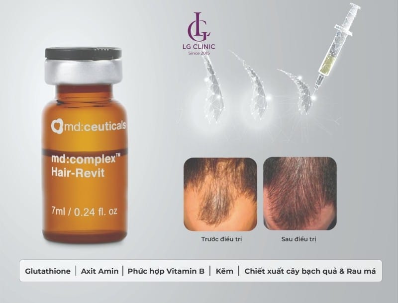 Làm sao chọn nơi tiêm mọc tóc uy tín tại HCM, Hà Nội và Cần Thơ — những tiêu chí cần kiểm tra?