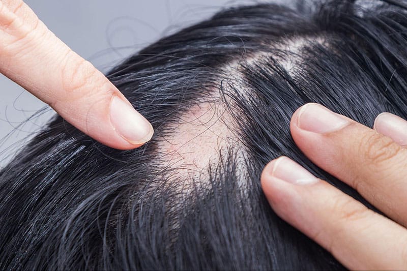 Ưu và nhược điểm khi so sánh nhanh một số lựa chọn