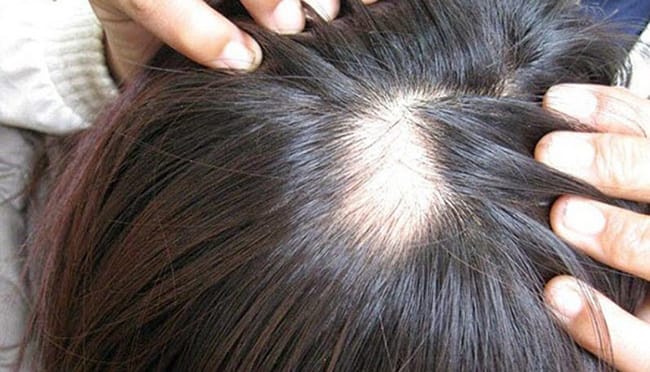 Ai không phù hợp với một số phương pháp?