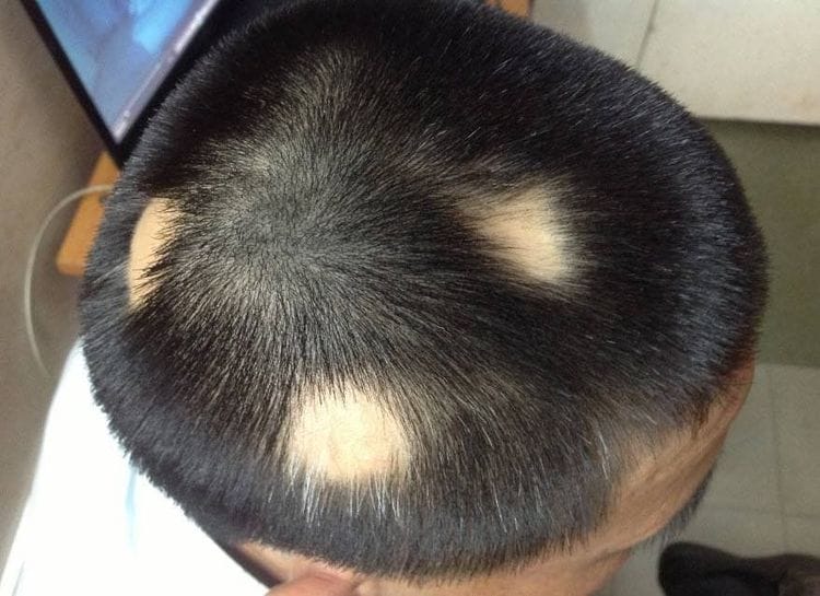 Phương pháp điều trị hiện có — so sánh hiệu quả và rủi ro