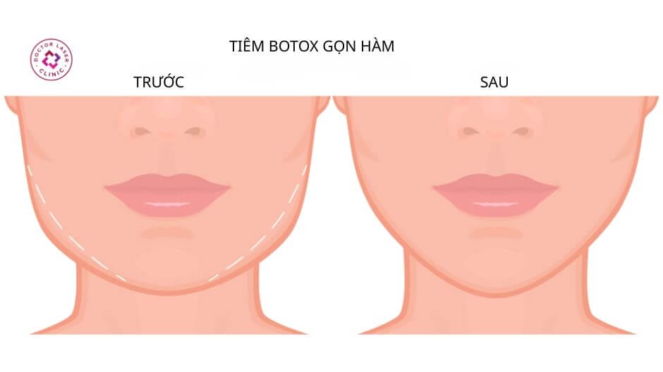 Vì sao nhiều người lo ngại về xoang?