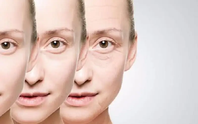 Tại sao bọng mắt và nếp nhăn thường xuất hiện cùng nhau?