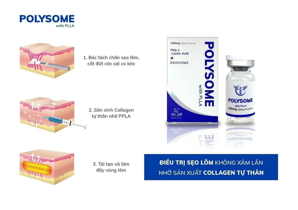 Những lưu ý thực tế trước khi quyết định làm bột chỉ PLLA