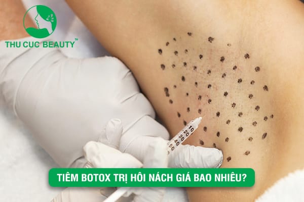 Botox nào được dùng tại Việt Nam?