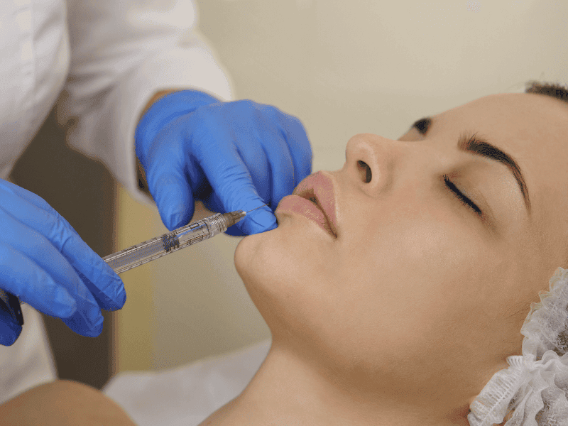 Bao lâu thì filler ổn định — khi nào là kết quả cuối cùng và có thể điều chỉnh?
