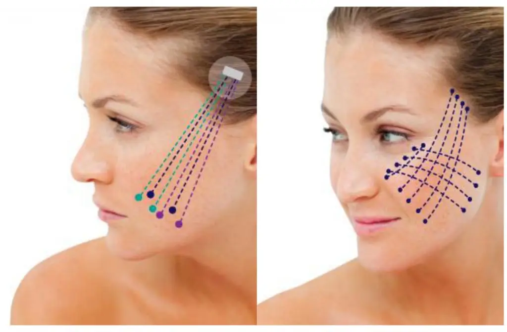 Chỉ collagen Hàn Quốc là gì — thực chất có phải chỉ làm từ collagen không?