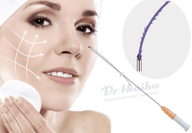 Chăm sóc sau cấy chỉ — những điều cần làm và cần tránh