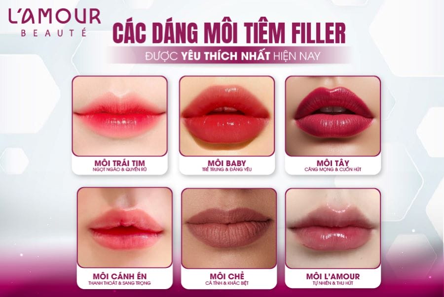 Rủi ro, biến chứng thường gặp và cách xử trí khi tiêm filler môi?