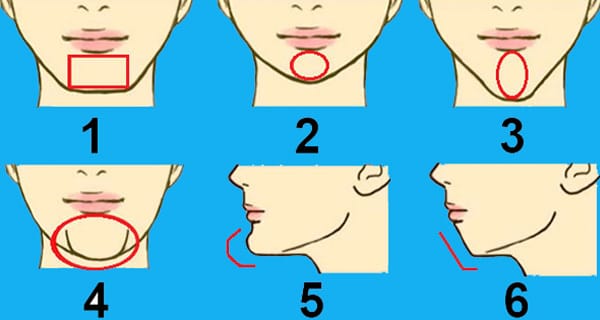 Phương pháp chỉnh hình cằm — phẫu thuật và không phẫu thuật khác nhau thế nào?