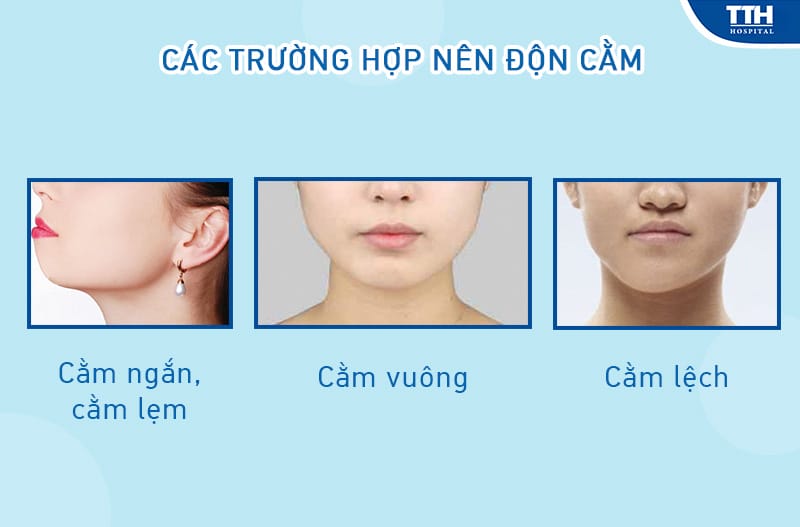 Những câu hỏi khách hàng thường tự hỏi — trả lời ngắn, thực tế
