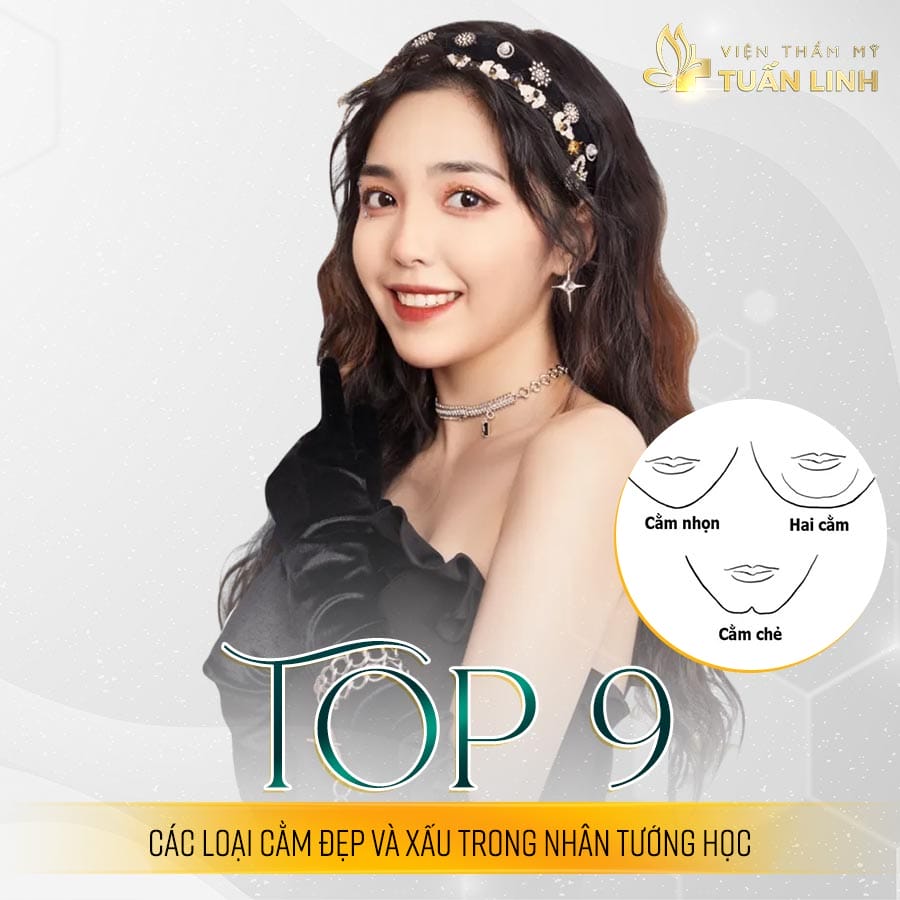 Chi phí có thể dao động thế nào?