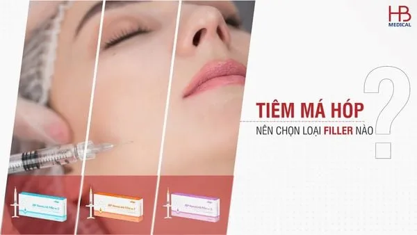 Loại filler nào phù hợp với mục tiêu: nâng má, làm đầy hõm, hay tạo góc cạnh?