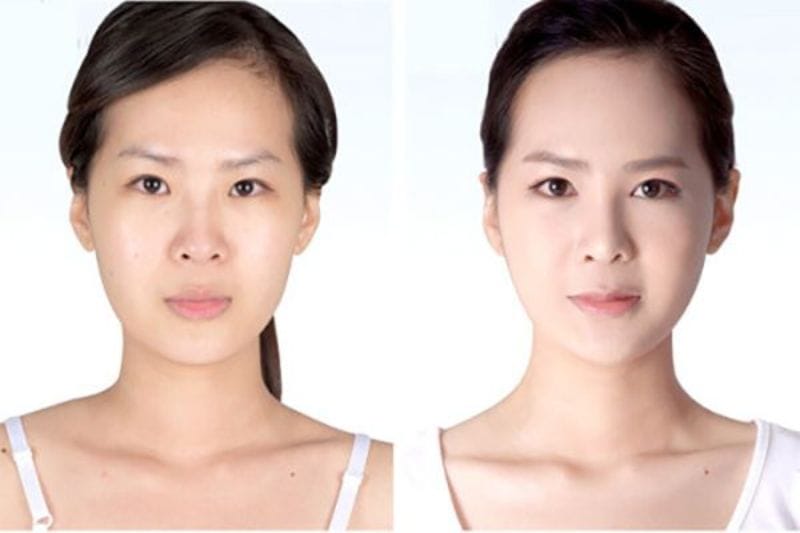 Nguy cơ và tác dụng phụ thường gặp — khi nào cần đến cơ sở y tế?