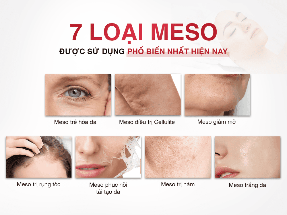 Những loại meso trắng da nào phổ biến và phù hợp với từng vấn đề da?
