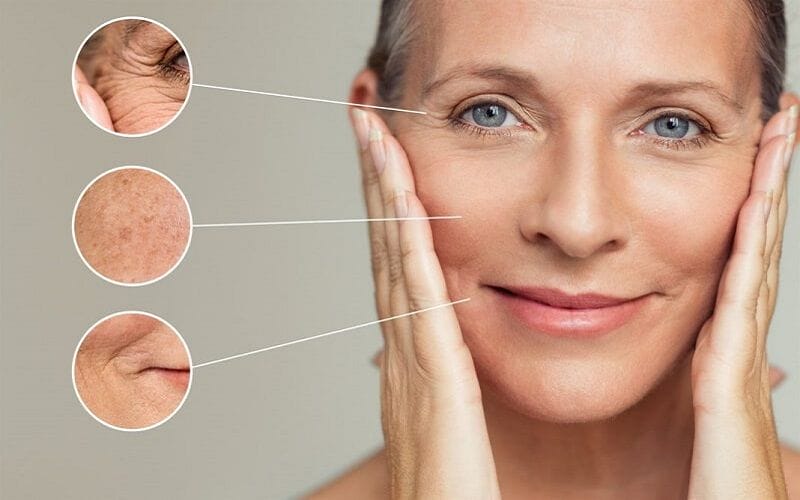 Microneedling, RF và các thủ thuật sinh học (PRP, mesotherapy)