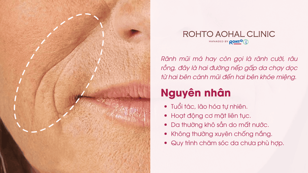 2. Cấy mỡ tự thân (fat grafting)