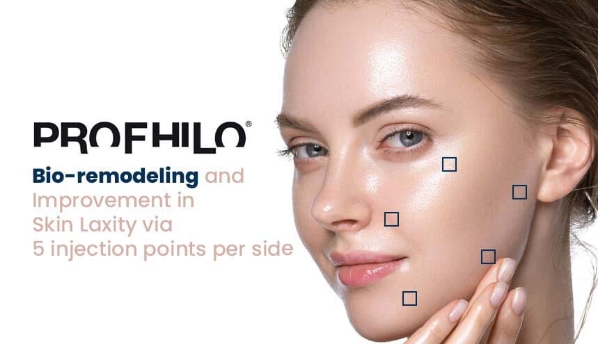 So sánh với phương pháp khác — nên chọn gì?